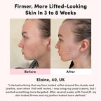 Facial Toning Device - Rechargeable Skin Lifting Massager