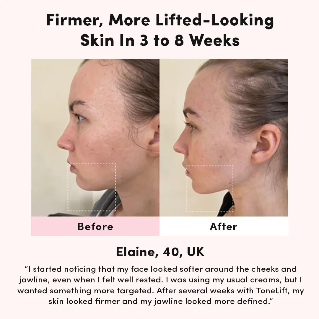 Facial Toning Device - Rechargeable Skin Lifting Massager